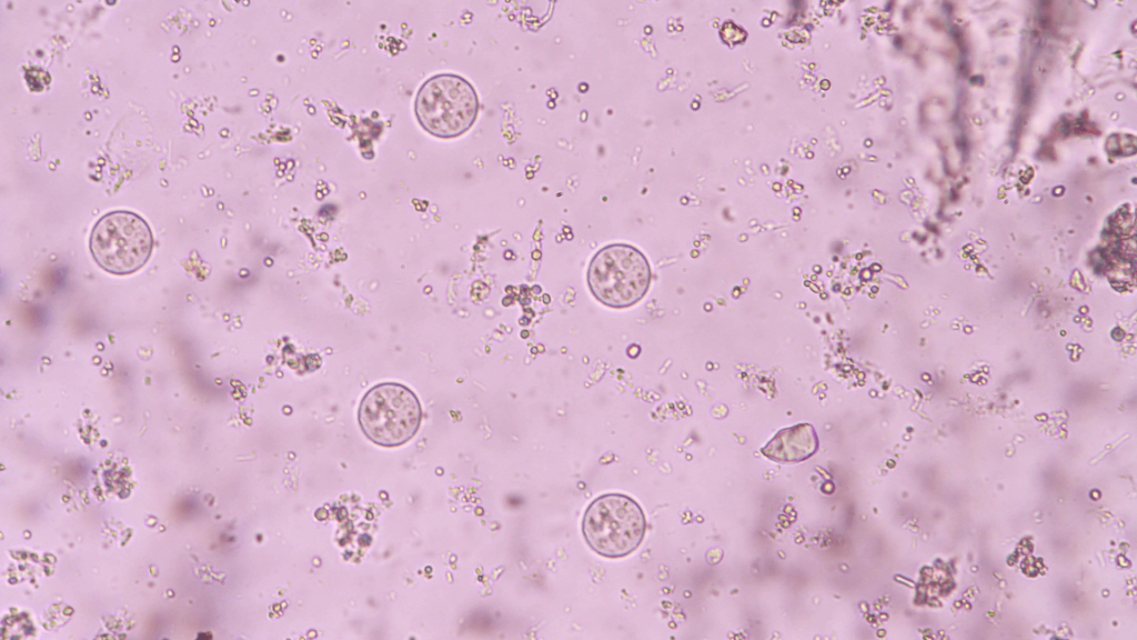 Jak oczyścić organizm z pasożytów